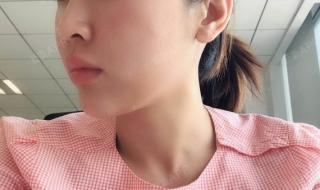 我说我想静静,女朋友问静静是谁,我该怎么回答好些 我会静静的